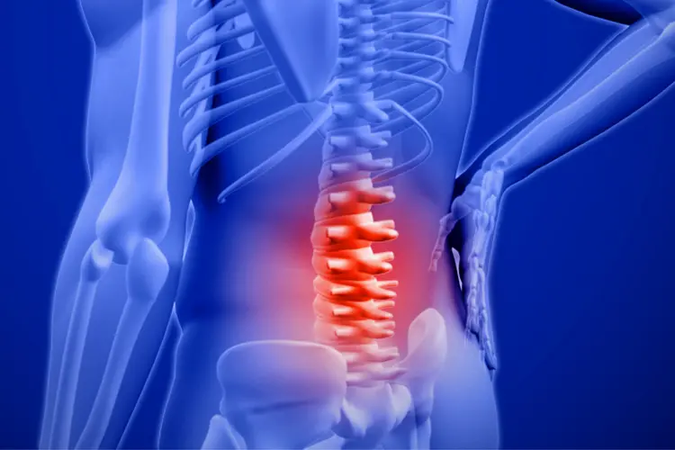 Advanced Spine Surgery in Bangalore, India – Gulf Corner Medical Tourism for Gulf Patients