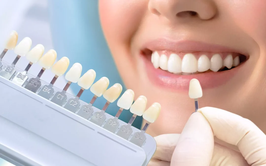 Best Dental Hospital in Bangalore for International Patients | Advanced Cosmetic, Restorative & Preventive Dental Care with Arabic Support
