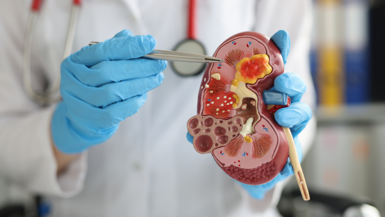 Transplants – Organ Transplant India for Foreigners | Kidney Transplant India Success Rate
